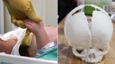 ‘3D 프린터’ 활용해 두개골 열린 채 태어난 아기 살려준 의료진